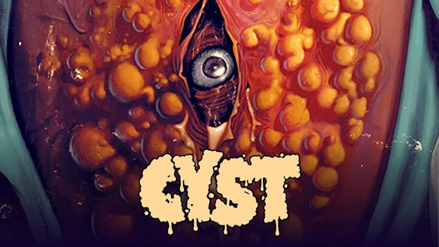 مشاهدة فيلم Cyst 2020 مترجم HD اون لاين